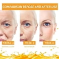 thumbnail image 5 of Suero blanqueador facial con vitamina C, elimina manchas oscuras, pecas, Retinol de melanina, esencia antiarrugas, brillo, cuidado de la piel coreano, 5 of 5