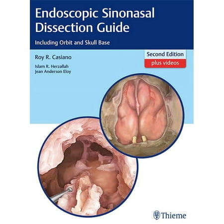UPC: 9781626232105 | Endoscopic Sinonasal Dissection Guide: Including Orbit and Skull Base (Other)