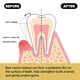 thumbnail image 4 of Bee Venom Gingival Protection Toothpaste for Deep Cleaning of Tooth Stains, Dental Smegma, Oral Odor, Fresh Breath, and Brightening Toothpaste, 4 of 5