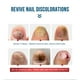 thumbnail image 3 of Suero De Uñas Líquido para el tratamiento de hongos, 10 ml, para aliviar la esencia de tratamiento de uñas encarnadas para el cuidado de los pies Tmvgtek Cuidado Belleza, 3 of 9