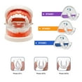 thumbnail image 2 of Orthodontic Teeth Trainer,Teeth Care Retainer,Dental Braces Kit,3 Stage Dental Braces Tooth Tray Retainer Straighten Aligner Trainer,Mouth Guard Orthodontic Teeth Straightener Corrector 1PC Clear, 2 of 8