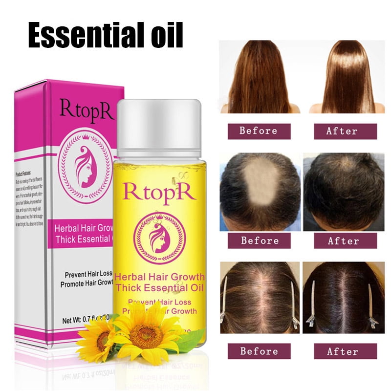 alextreme 20Ml Hair Growth Thick Essential Oil Hair Scalp Care Treatment for Men Women alextreme 20Ml Hair Growth Thick Essential Oil Hair Scalp Care Treatment for Men Women