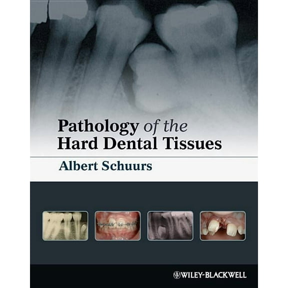Pathology of the Hard Dental T, (Hardcover)