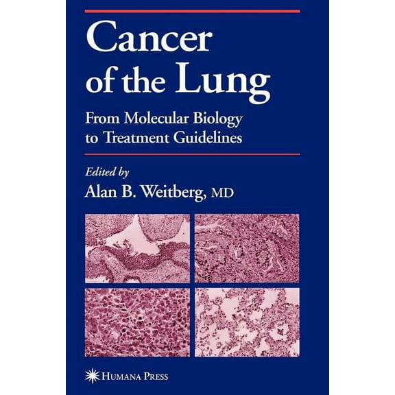 Current Clinical Oncology Cancer of the Lung: From Molecular Biology to Treatment Guidelines, (Paperback)