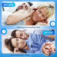 thumbnail image 5 of Canalón dental termoformable para bruxismo, 4 unidades, protectores bucales sin BPA, protector dental nocturno, antirechinamiento de dientes, protector dental de boxeo, 5 of 5