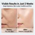 thumbnail image 5 of Ribose Skin Cream, 60ml , Rejuvenating Formula with D-Ribose, Hyaluronic Acid, Vitamin E + B5, 5 of 8