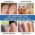 thumbnail image 5 of Extra Strong Fungal Nail Treatment - Effective Solution For Finger & Toenail Fungus, Protects Thick, Broken, Discolored Nails, Restores Discolored Nai, 5 of 5