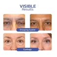 thumbnail image 3 of Double Eyelid Shaping Beauty Cream Lifting Eyelid Defining Cream, 3 of 5