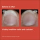 thumbnail image 5 of Sérum fortalecedor de uñas para cutículas ISDIN SI-NAILS, 5 of 9