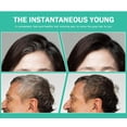 thumbnail image 4 of Tónico facial Hyalogic con hamamelis 8oz - Spa HA ácido hialurónico y aloe vera tónico hidratante sin alcohol astringente para la cara 8 fl oz, 4 of 5