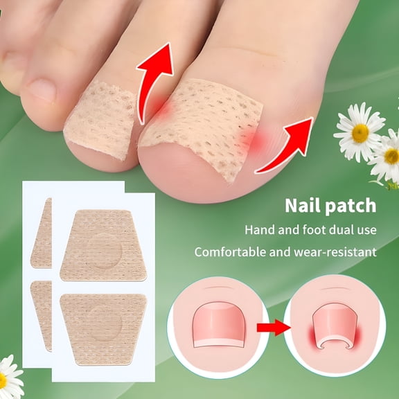 RAGUPEL 5 Pairs Nail Care Patch Ingrown Toenail Correction Patch Ingrown Toe Nail Treatment Soft Nail Repair Patch Foot Care Tool
