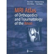 MRI Atlas of Orthopedics and Traumatology of the Knee, (Hardcover)