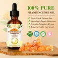 thumbnail image 3 of (3 pack) Aliver Frankincense Essential Oil – 100% Pure & Natural, Therapeutic Grade, Aromatherapy & Skin Care, Massage Body Oil – 60ml, 3 of 11