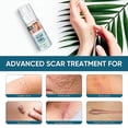 thumbnail image 2 of Fade Scar Gel, Surgical Skin Repair Cream, Advanced Scar Therapy For Surgery, C-section, Keloid, Injury, Burns, Scars Smoothing, 2 of 5