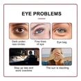 thumbnail image 4 of Anti Puff Eye Roller Serum Anti Dark Circle Wrinkle Repairing Skin For Fine Lines Eye Bags, 4 of 5
