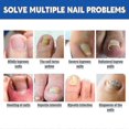 thumbnail image 4 of Jaysuing nail groove care patch repair thickened onychomycosis soft nail correction nail groove ingrown toenail nail correction patch |, 4 of 5