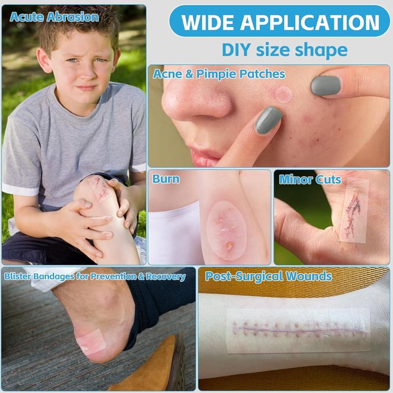 Hydrocolloid Dressing Roll for Wound Care, 4in*10ft, Cut-to-Size Patch,  Hydrocolloid Bandages with Self-Adhesive, Ultra Absorbent, Flexible & ...