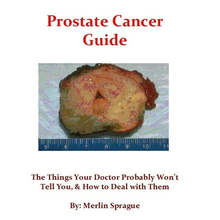 Prostate Cancer Guide, The Things Your Doctor Probably Won't Tell You, & How To Deal With Them. -