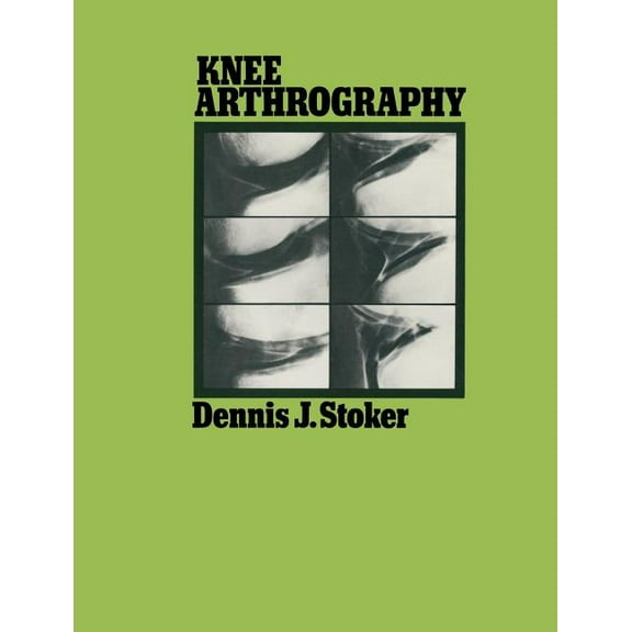 Knee Arthrography, (Paperback)