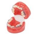 thumbnail image 3 of Alambres De Metal Modelo Dental, Modelo Dental Alambres De Metal 24 Dientes Medio Metal Medio Soporte De Cerámica Diente Modelo Correcto Para La Enseñanza Del Estudio, 3 of 5