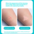 thumbnail image 2 of OITY Hydrocolloid for Wound Care,Scar Reducing Tape,Scar Solutions Silicone Scar Sheets,Cut-To-Size,Self-Adhesive Hydrocolloid Bandages for Burns,Waterproof,Ultra Absorbent (2In*12Ft), 2 of 7