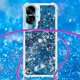 thumbnail image 5 of Funda FOXDOCK para Honor 90 Lite con Cuerda Ajustable, Brillo Líquido, Protección Antigolpes y Lente – Ideal para Regalo, 5 of 6