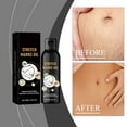 Clearance!! suhtpsw Prophylaxis Stretch Marks During Pregnancy With