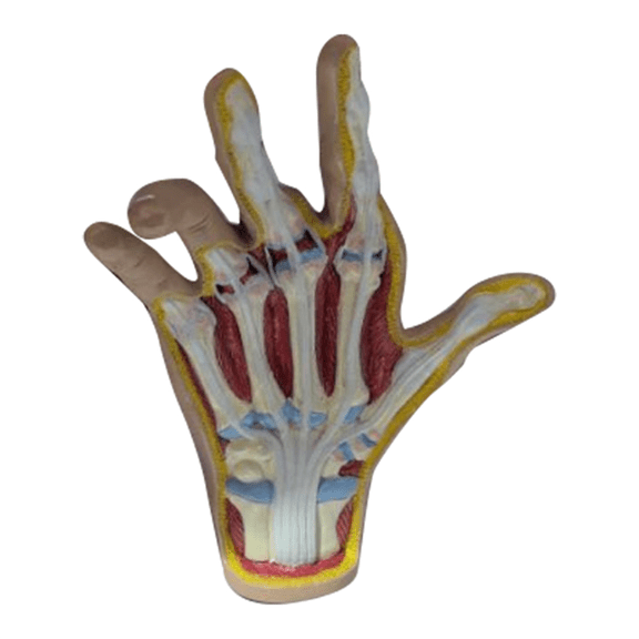 Osteoarthritis Hand Model, Model of Hand Pathology