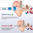 thumbnail image 3 of New Oroclear Earwax Remover, Electric Ear Cleaner, Oroclear Ear Wax suction remover, 3 of 5