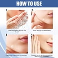 thumbnail image 2 of Vogacara Skin Set Professional Painless Warts Removing Moles Remover Labels Patch Removers Type2 NO2 Vogacara CE014754-01, 2 of 6