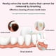 thumbnail image 5 of Seitruly Pulidor de limpieza de dientes, luz LED, resistente al desgaste, resistente al agua, removedor de placa dental, pulidores, de alta cuidado de los oídos Rosado Seitruly CE000397-02B, 5 of 6