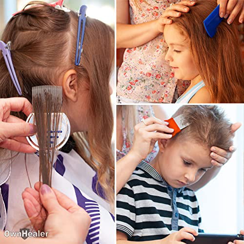 HOW TO GET RID OF LICE EGGS ON HAIR