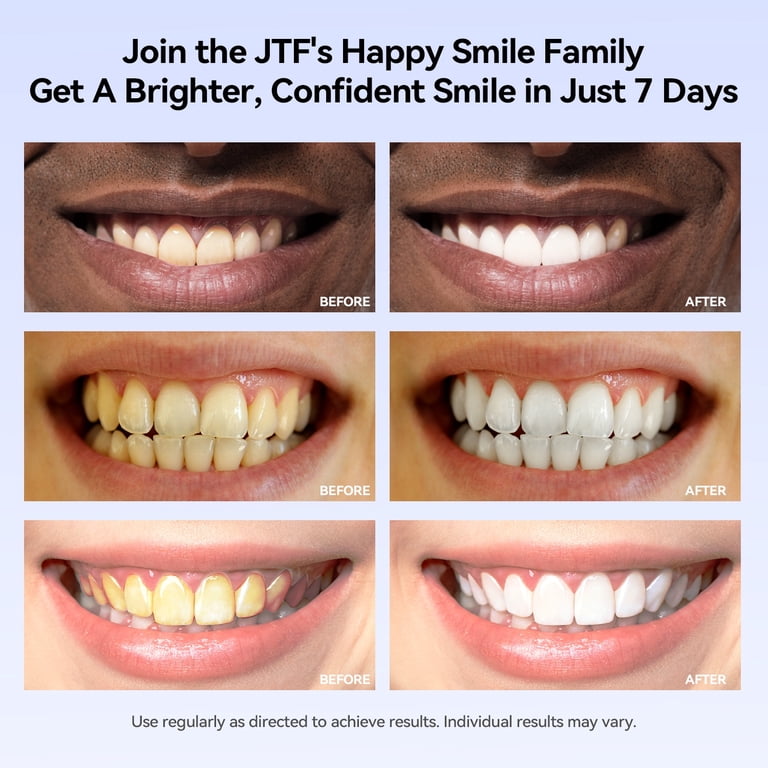 JTF Teeth Whitening Pen Gel Kit, 35% Carbamide Peroxide, 8 Pack photo 4