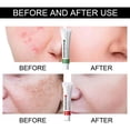 thumbnail image 2 of Crema hidratante, crema hidratante, crema facial 10 piezas Crema antipecas Crema hidratante antiarrugas y rejuvenecedora Crema para atenuar marcas y crema 20 g por crema, 2 of 5