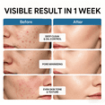 thumbnail image 4 of Glycolic Acid Toner Solution Exfoliating Face Toner for Dark Spots Uneven Skin 8.45 fl oz, 4 of 8