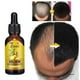thumbnail image 4 of EELHOE Ginger Hair Care Solution (40ml) Solución nutritiva nutritiva para el cabello, cuidado del cabello, prevención de la caída del cabello,1 piezas, 4 of 9