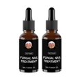 thumbnail image 1 of 2pcs Anti Fungal Nail Treatment Repair Finger Toe Care Nail Fungus Liquid, 1 of 4