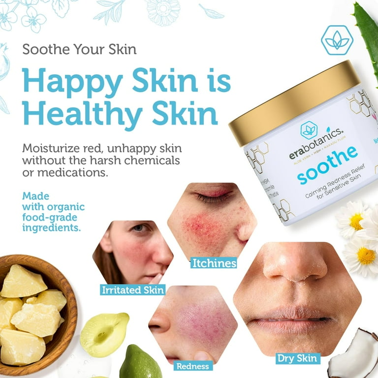 Era Organics Rosacea Redness Relief Cream - Soothe Dry Skin Irritation  Calming Face Moisturizer For Rosacea, Eczema, Acne Prone Skin- Sensitive  Skin ...