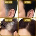 thumbnail image 3 of Maoww Shampooing Colorant Inversé 200ml/30ml Polygonum Multiflorum Gingembre Soin des Cheveux, 3 of 8