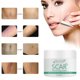 thumbnail image 4 of EELHOE Crema EELHOE de 30ML para cicatrices y manchas, con extractos naturales que suavizan y aclaran la piel de manera efectiva., 4 of 6