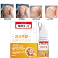 thumbnail image 4 of Aceite para el tratamiento de hongos en las uñas, esencia antiinfecciones, onicomicosis, 10 ml, paroniquia, uñas de los pies, hongos, reparación, cuidado, 4 of 6