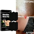 thumbnail image 4 of Blackhead Nose Patch  Nose Pore Cleansing Strips 10 Pcs Blackhead Nose Patch Nose Pore Cleansing Strips Deep Cleansing Blackhead Remover Strips For Women Men, 4 of 8