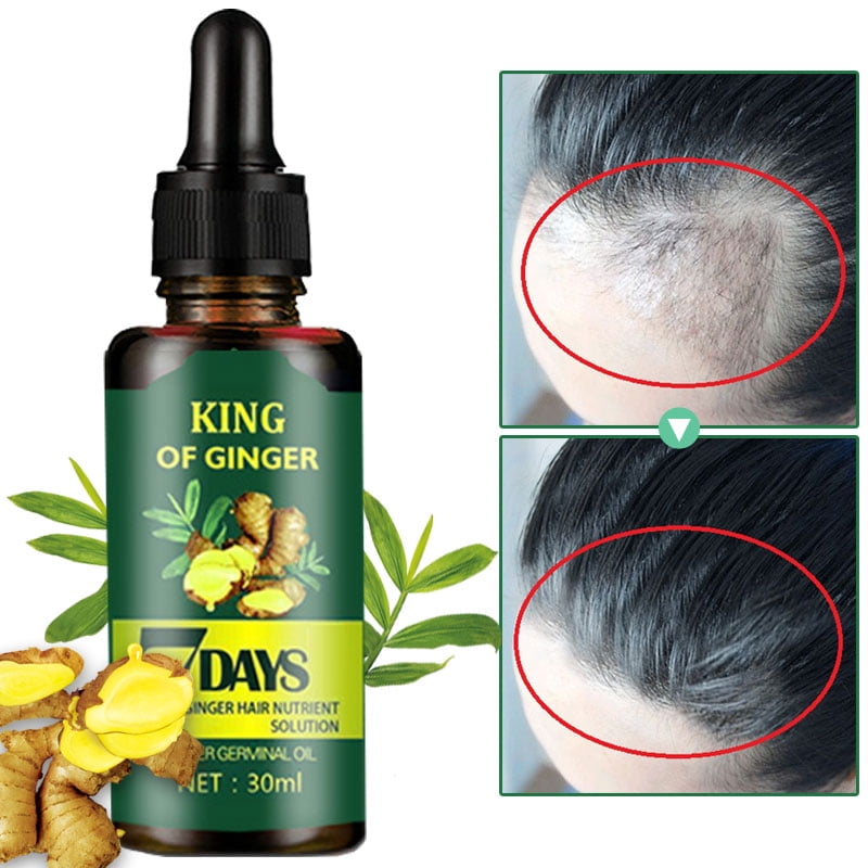 Hair Growth Products Ginger Fast Growing Hair Essential Oil Beauty Hair  Care Prevent Hair Loss Oil Scalp Treatment For Men Women 