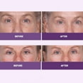 thumbnail image 4 of INSTA-TOX Sérum Raffermissant pour le Visage, Lissant les Rides et Crème Raffermissante Reverse Lift - Raffermisseur pour les Ridules, les Rides Profondes et les Pores - Lift Temporaire pour le Visage et les Yeux - Serious Skinca, 4 of 9