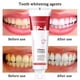 thumbnail image 4 of Pasta de dientes blanqueadora de 120g, reparación de caries, pasta de dientes probiótica, limpieza de dientes bucales JShteea El nuevo, 4 of 7
