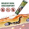 thumbnail image 3 of 3X New Mite Removal Ointment Anti-Itching Plaster Kill Head Lice Skin Care Natural, 3 of 5