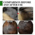 thumbnail image 4 of 30pcs Rosemary Hair Tonic Stimulates Essential Oil For Anti Hair Loss Hair Growth Nourishment Scalp Hair F, 4 of 5