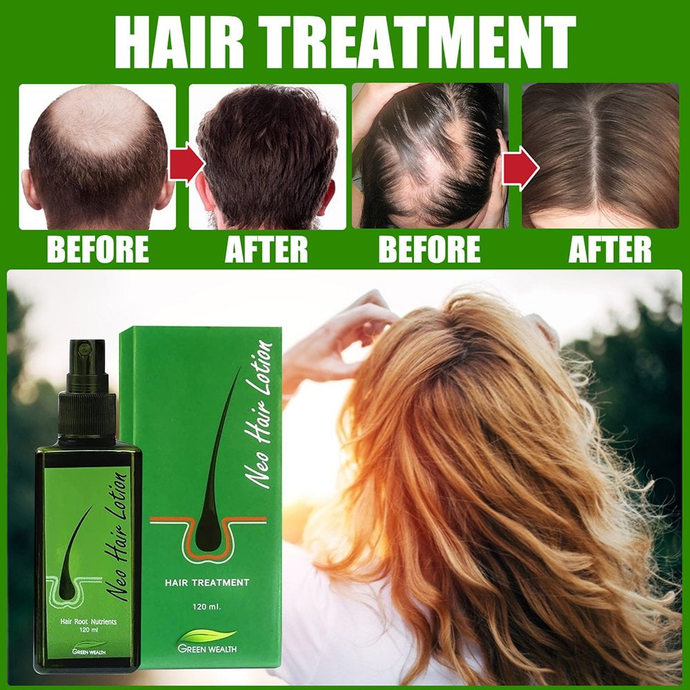 Hair Lotion Spray Grow Hair and Nourish Hair Roots Hair Regrowth -  Walmart.com