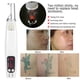 thumbnail image 4 of Pluma de picosegundo, Dispositivo de eliminación de manchas de cicatrices de picosegundo de luz roja Pluma de eliminación de tatuajes Funcionalidad versátil, 4 of 12