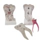 thumbnail image 4 of Modelo Molar de Modelo de para Accesorio Educativo Práctico, 4 of 7